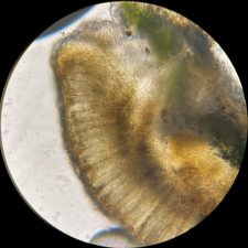 Biatora vernalis, coupe d'apothécie