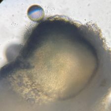 Epithamnolia pertusariae