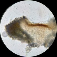 Lecanora argentata