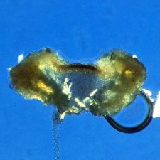 Lecanora argentata, cristaux POL+ avant KOH