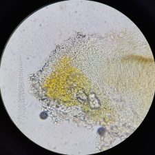Lecanora argentata, cristaux (après KOH)