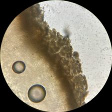 Lecanora chlarotera, granules grossières sur l'épithécium