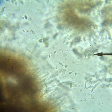 Lecidea albofuscescens, spores