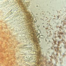 Lecidea lactea, Acide norstictique