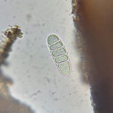 Megalospora porphyritis, spore