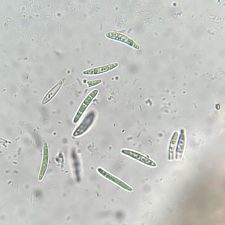 Micarea lignaria, spores fusiformes