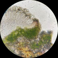 Micarea lignaria, excipulum