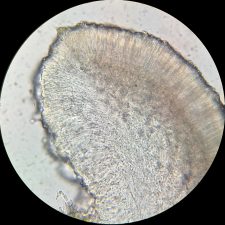 Mycobilimbia carneoalbida, coupe d'apothécie