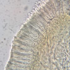 Mycobilimbia carneoalbida, coupe d'apothécie