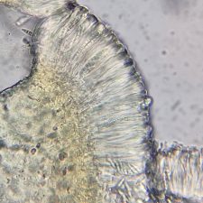 Mycobilimbia carneoalbida, coupe d'apothécie