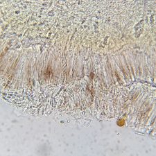 Mycobilimbia obscurata, spores
