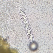 Pertusaria alpina