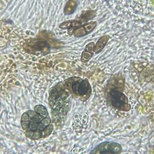 Rinodina freyi, spores