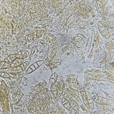 Thelidium incavatum, spores hyalines à 3 septa