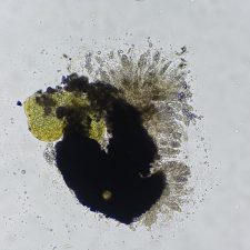 Verrucaria calkinsiana