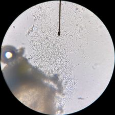 Epithamnolia pertusariae, conidies