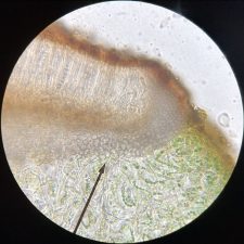 Lathagrium undulatum, coupe d'apothécie