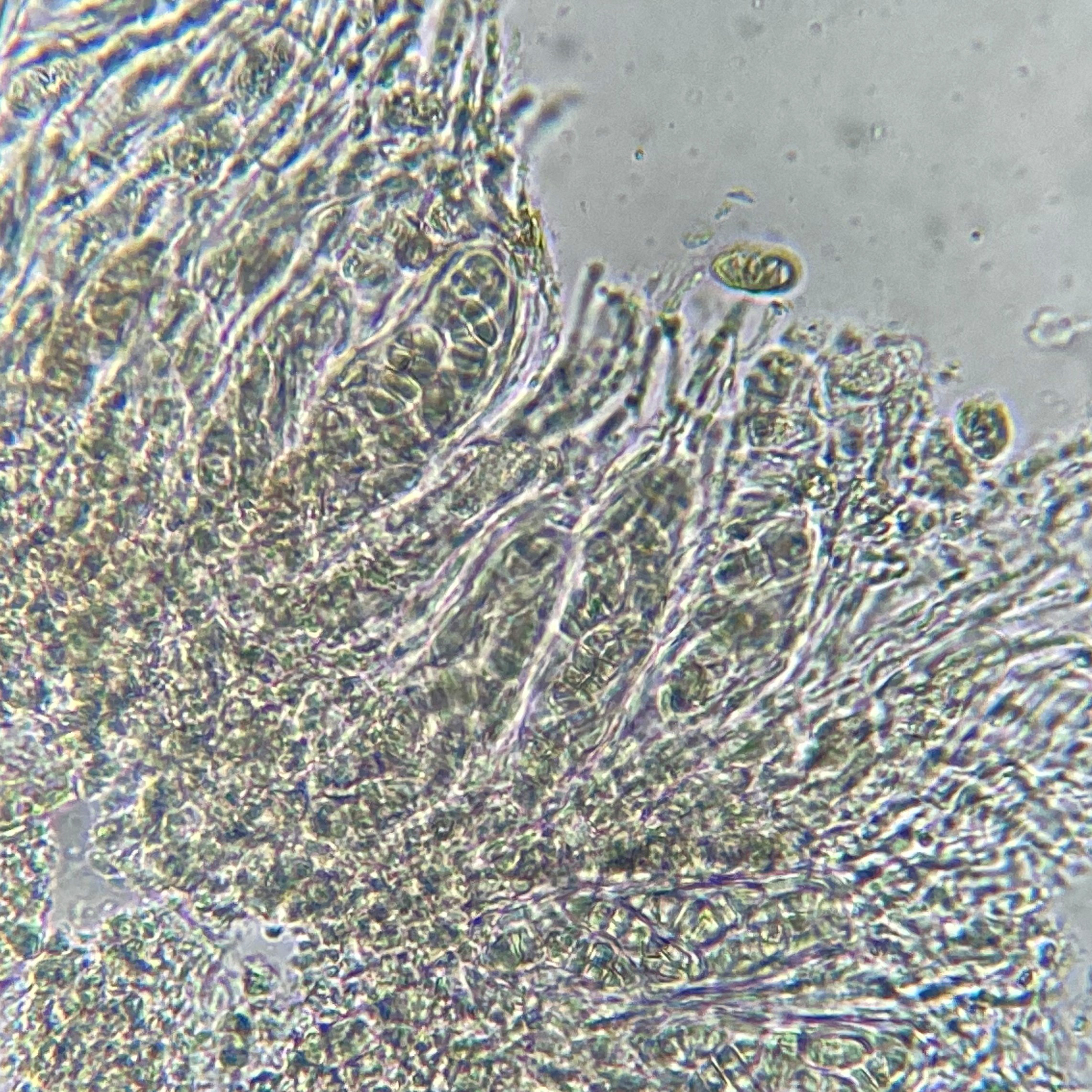 Spores hyalines, muriformes